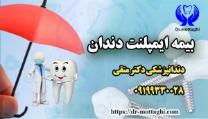 بیمه ایمپلنت دندان